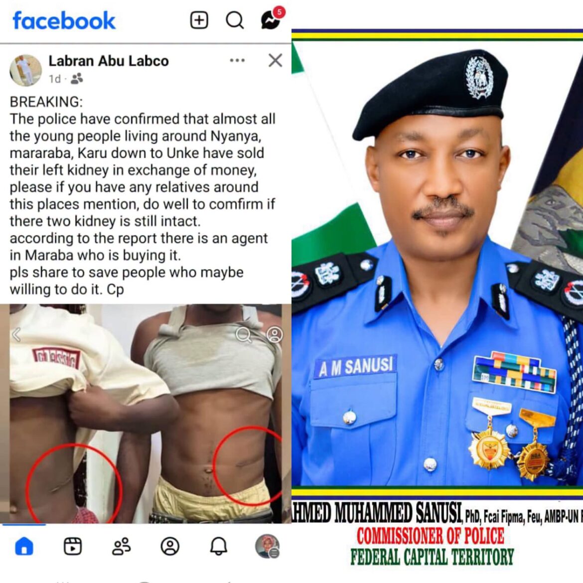 Police debunks kidney sales report in Nyanya