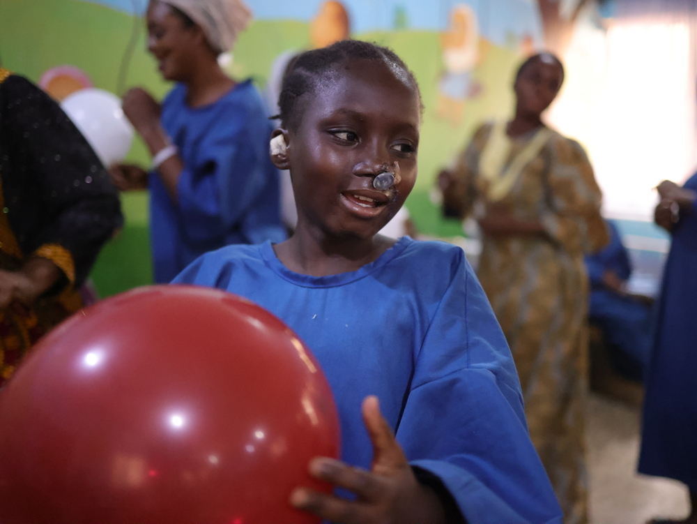 MSF urges Nigeria to integrate noma care into primary healthcare